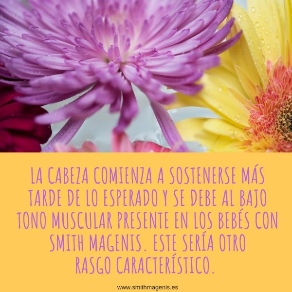 5 INDICIOS PARA SOSPECHAR QUE TU HIJO TIENE SMITH MAGENIS